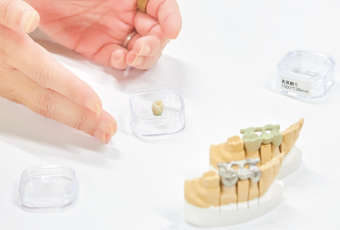 白い金属で効率的に歯の色に近づける