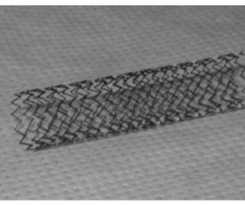 治療に使用される自己拡張ステント